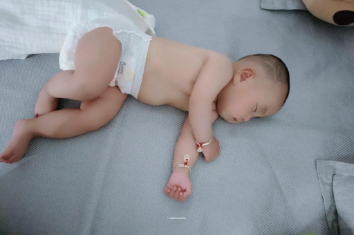 乳山宝宝头上长痱子